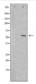 Cytochrome P450 2A13 Antibody
