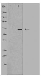 EIF2AK1 Antibody