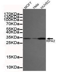 RPA32/RPA2 Mouse mAb