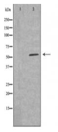 Cytochrome P450 26A1 Antibody