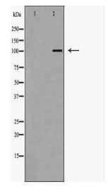 CSF1R Antibody