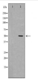EDNRB Antibody