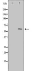 GABRB2 Antibody