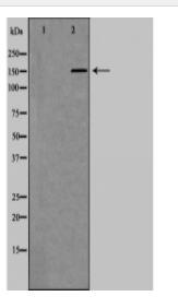 ASK1 Antibody