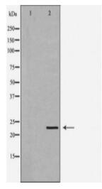 GSTP1 Antibody