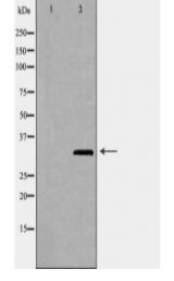 FBL Antibody