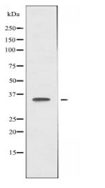 ATPBD3 Antibody