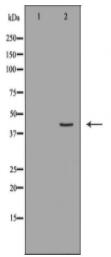 HLA-A Antibody