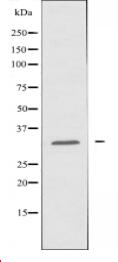 GSTT1/4 Antibody