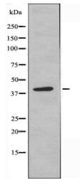 DNAJB11 Antibody