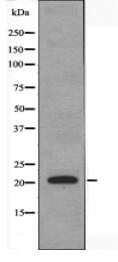 DUSP22 Antibody