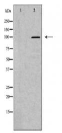 HK2 Antibody