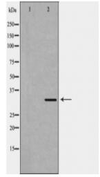 HADH Antibody
