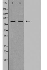 CPT1B Antibody