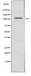 EPHA2 Antibody