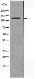 DGKD Antibody