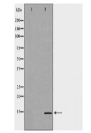 FABP1 Antibody