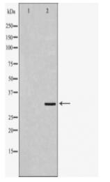 ECI1 Antibody