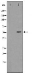 EPHX1 Antibody