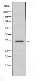GHITM Antibody