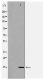 Histone H3R2me2s Antibody