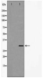 GCLM Antibody