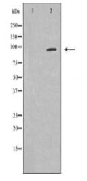 DLGAP5 Antibody