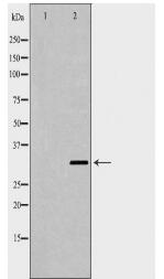 CD274 Antibody