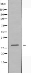 ELOVL5 Antibody
