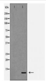 DBI Antibody