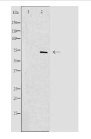 ALS2CR11 Antibody