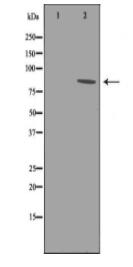 EEF2K Antibody