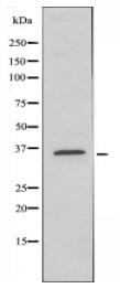 FGFP2 Antibody