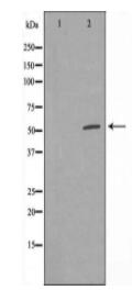 DNTT Antibody