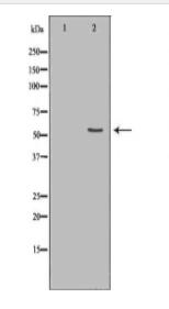 CYP2E1 Antibody