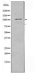 EPHA5 Antibody