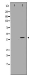 CTSK Antibody