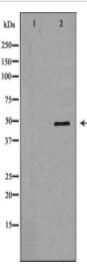 E2F1 Antibody