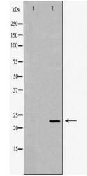 CRYBB2 Antibody