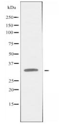 CYB5R3 Antibody