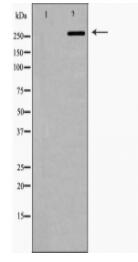 FASN Antibody