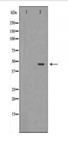 DCX Antibody