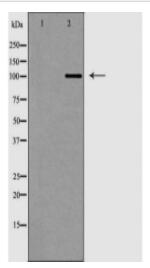 CTNND1 Antibody