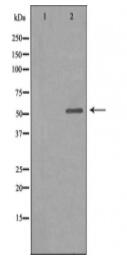 GLR Antibody