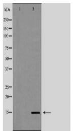 Histone H3R26me2a Antibody