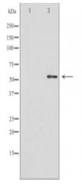 GBA3 Antibody