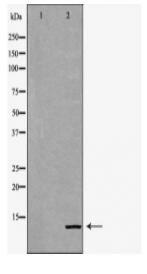 EIF4EBP1 Antibody