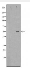 GFAP Antibody