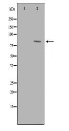 ADRBK2 Antibody