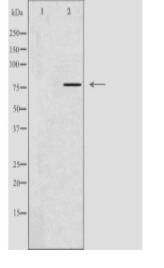 GNPAT Antibody
